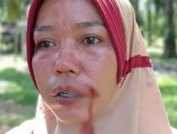 Oknum TNI AL, Diduga Aniaya 2 IRT di Kecamatan Tanjung Pura, Dituding Curi Berondolan Sawit