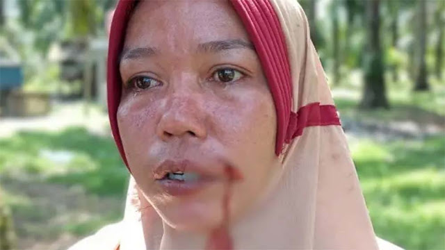 Oknum TNI AL, Diduga Aniaya 2 IRT di Kecamatan Tanjung Pura, Dituding Curi Berondolan Sawit