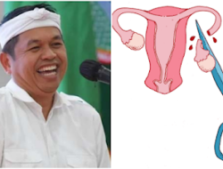 Dedi Mulyadi Mau Jadikan Vasektomi Syarat Terima Bansos, Komnas HAM: Langgar Hak Privasi