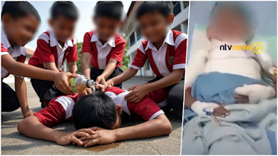 Tragis! Bocah SD di Situbondo Dibakar 4 Temannya Pakai Spiritus, Kondisinya Kritis