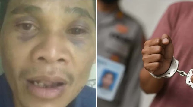 Pemuda Jadi Korban Salah Tangkap Anggota Polres Cianjur. Kondisi Badan Penuh Luka dan Babak Belur