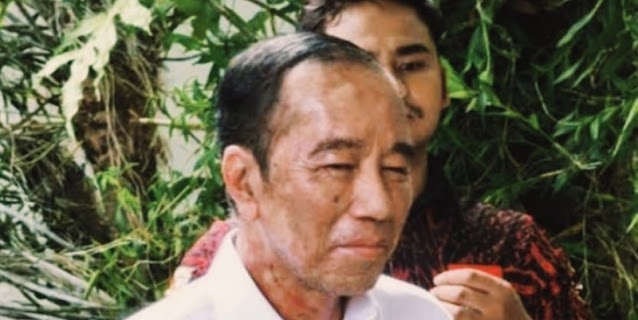 Dokter Tifa Peringatkan Jokowi Tak Sepelekan Sakit Kulitnya