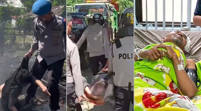 Diduga Salah Tangkap! Kepala Puskesmas di Polewali Mandar Alami Pendarahan Otak Usai Dihajar Polisi