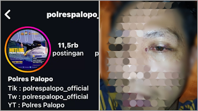 Akun Instagram Polres Palopo Diserbu Netizen, Protes Korban Penganiayaan Jadi Tersangka