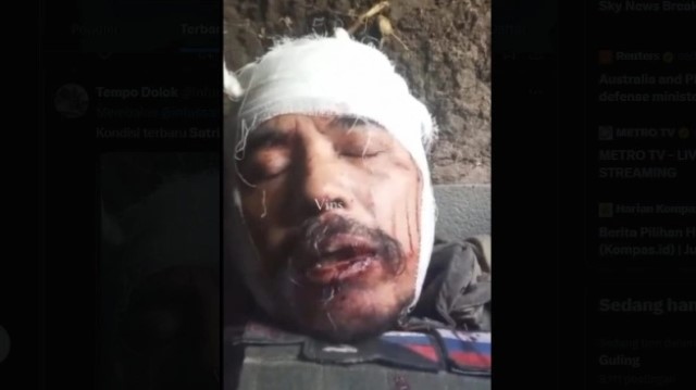 Astaga! Kepala Penuh Luka, Begini Kondisi Eks Marinir Satria Kumbara Usai Dihantam Drone Kamikaze