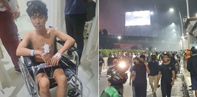 Kader PMII Tertembak Peluru Karet saat Demo di Kawasan Kwitang