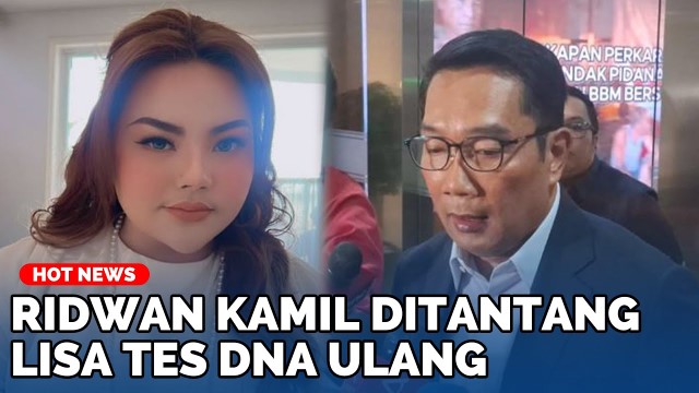 Hasil Tes DNA Ridwan Kamil Setengah Mirip Dengan Anak Lisa Mariana, Benarkah Ada Kejanggalan?