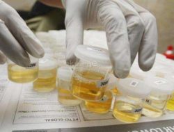 Onadio Leonardo Positif Ganja dan Ekstasi, Teman Onad Juga Terbukti Pakai Narkoba