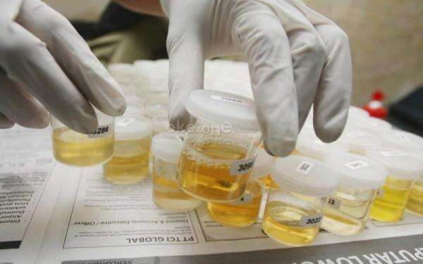 Onadio Leonardo Positif Ganja dan Ekstasi, Teman Onad Juga Terbukti Pakai Narkoba