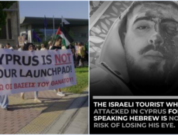 Turis Israel Kehilangan Mata Usai Dipukuli Brutal di Siprus, Hanya Karena Bicara Bahasa Ibrani