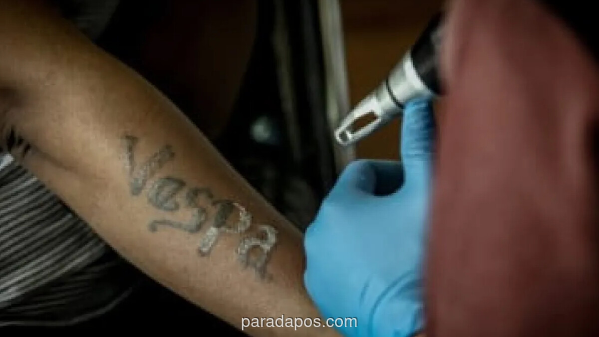 Baznas DKI Gelar Layanan Penghapusan Tato Gratis, Antusias Warga Tinggi