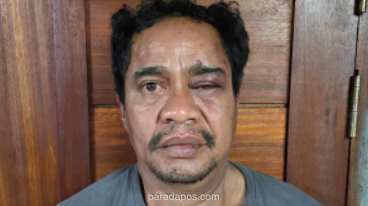 Bareskrim Tangkap Bandar Narkoba Diduga Setor ke Mantan Kapolres Bima