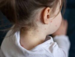 IDAI Serukan Kejar Imunisasi Campak, Indonesia Peringkat Kedua Kasus Tertinggi Dunia